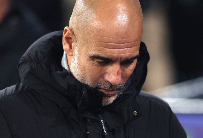 Pep Guardiola explains cut on his nose after Man City draw vs Feyenoord